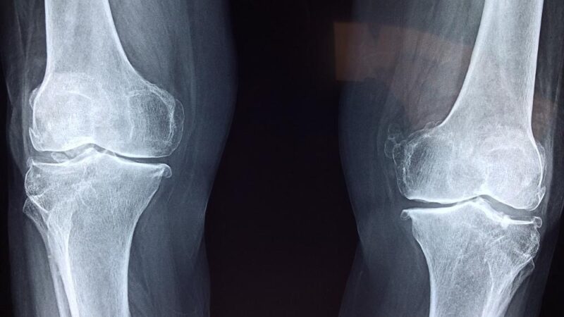 Jakie badania powinien wykonać sportowiec?