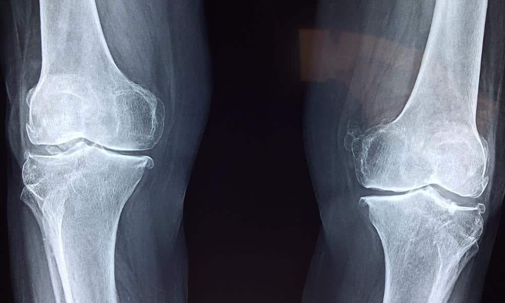 Jakie badania powinien wykonać sportowiec?