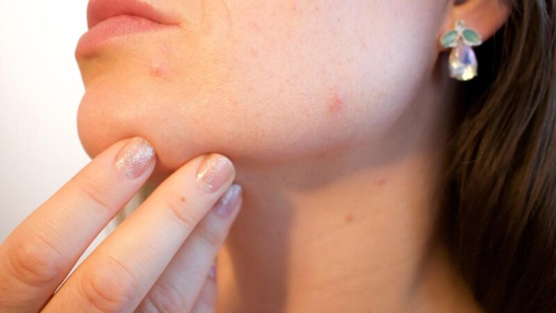 Kiedy warto skonsultować się z dermatologiem? Przewodnik, który rozwieje Twoje wątpliwości