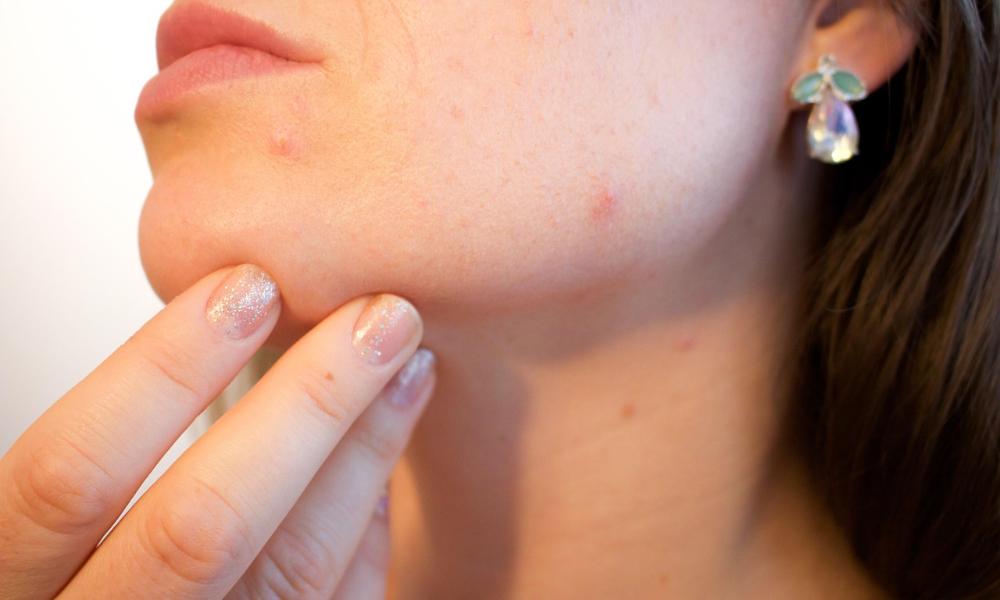 Kiedy warto skonsultować się z dermatologiem? Przewodnik, który rozwieje Twoje wątpliwości