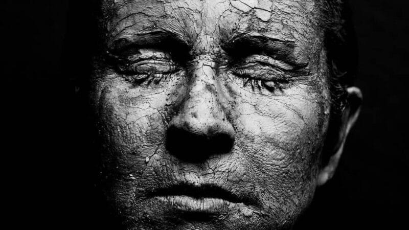 Czy dieta wpływa na trądzik?