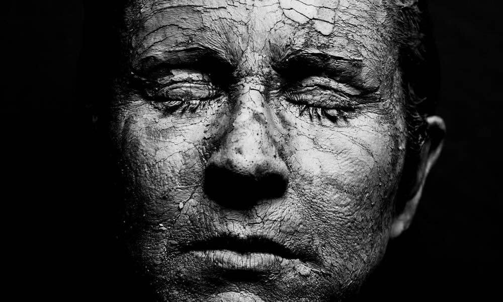 Czy dieta wpływa na trądzik?