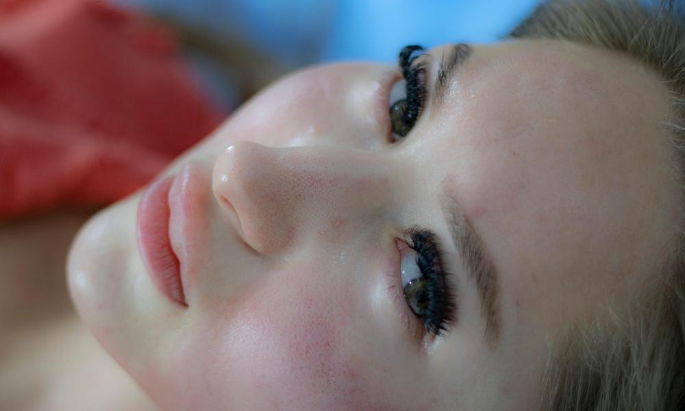 7 najczęstszych błędów w pielęgnacji cery trądzikowej – sprawdź, czy ich nie popełniasz!